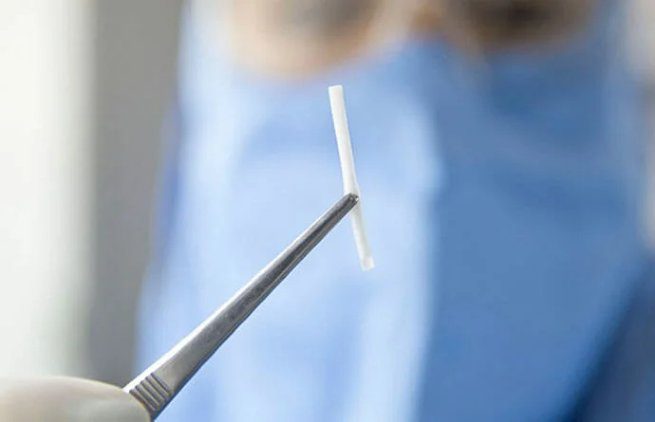 Prefeitura de São Sebastião disponibiliza implante contraceptivo de longa duração para mulheres com condições especiais