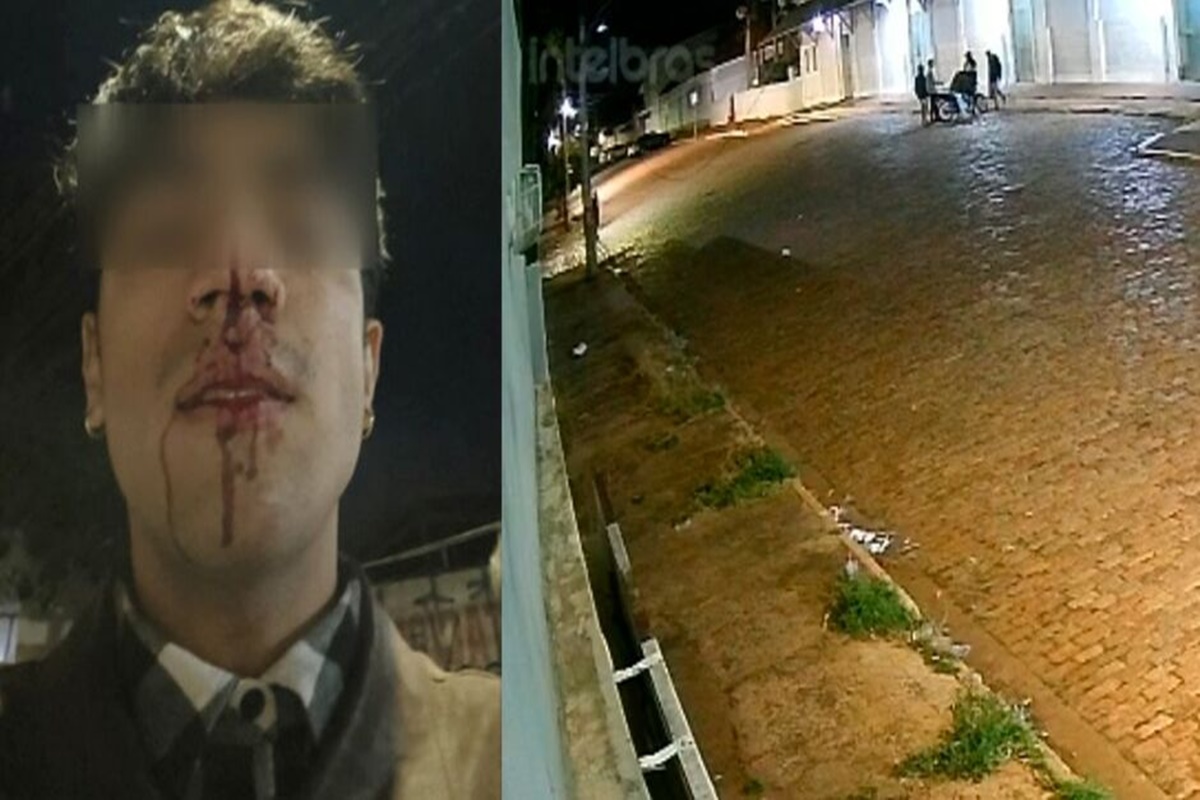 Câmera de segurança registrou o espancamento de um artista, de 23 anos, que apanhou de 10 homens, na madrugada de sábado (9/8), por homofobia.
    Leia também