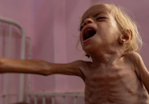 ONU declara oficialmente estado de fome na Faixa de Gaza, apontando os ataques de Israel como causa da crise humanitária catastrófica. A situação é crítica para a população civil.