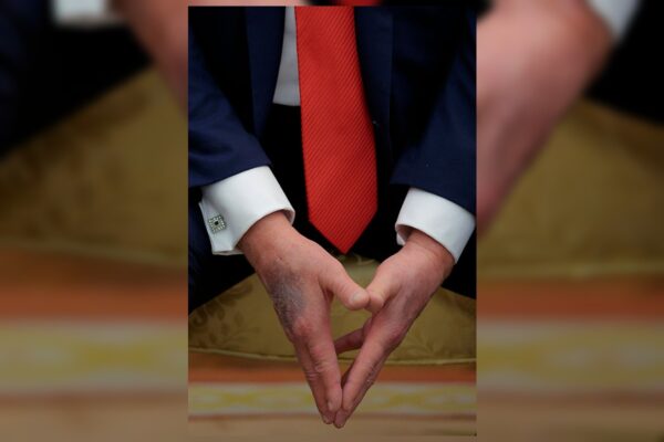 O presidente dos Estados Unidos, Donald Trump, reapereceu com a mão direita roxa nesta segunda-feira (25/8). Em julho deste ano, houve situação semelhante e a C