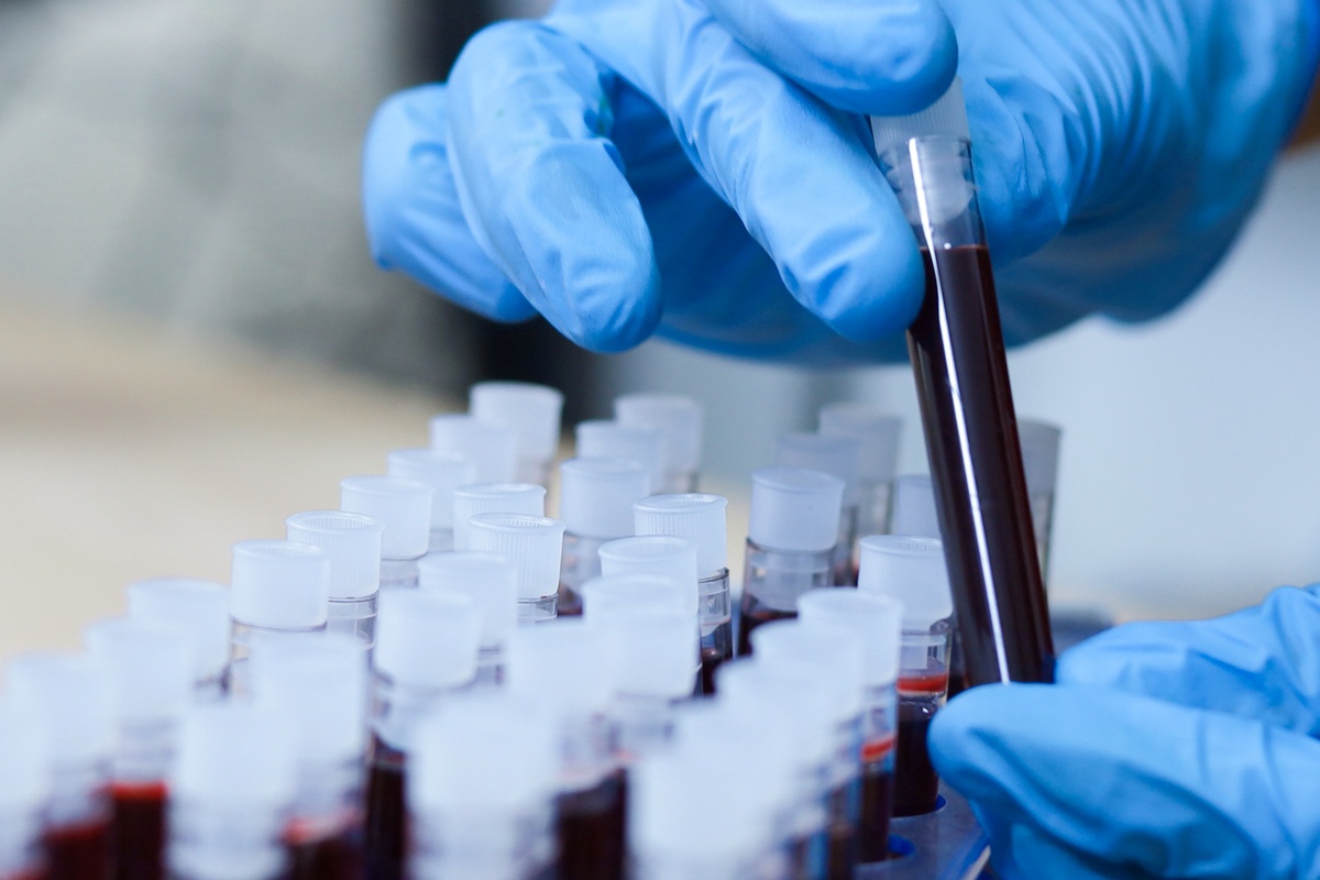 Pesquisadores descobriram parte do mecanismo por trás do chamado “efeito rejuvenescedor” do sangue jovem. A equipe demonstrou, pela primeira vez, que proteínas