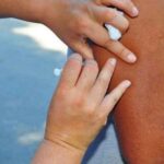 Caraguatatuba Vacina Contra Febre Amarela