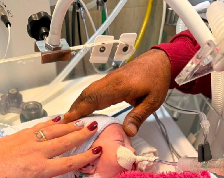 Bebê declarado morto apresenta sinais vitais