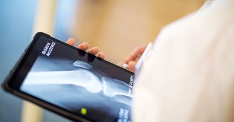 Barra Funda oferece exames gratuitos contra osteoporose