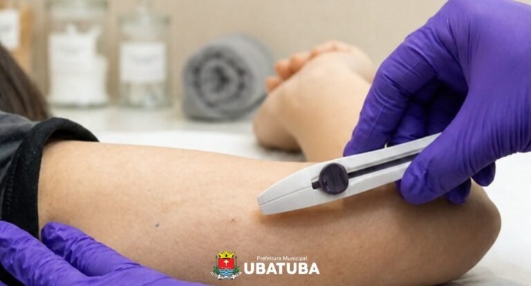 Saúde promove capacitação de enfermeiros para implante de anticoncepcional